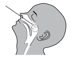 COVID-19-SARS-CoV-2-Antigen-Test-Kit-Operation-Steps-2.png