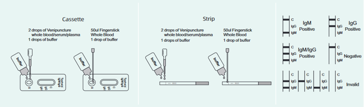 typhoid-iggigm-rapid-test-operation.png